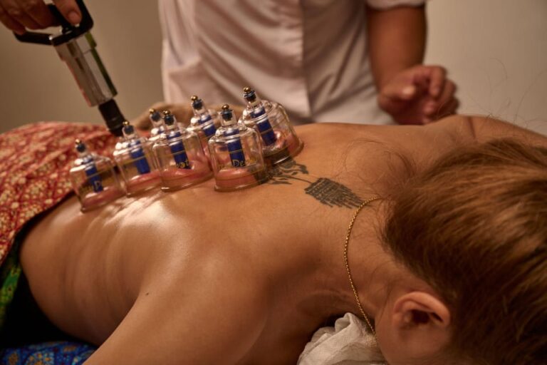 Cupping Therapy