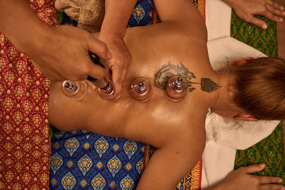 Cupping Therapy - Choosing a Practitioner