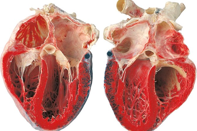 Ticket Expo Body Worlds Review: A Fascinating Experience - Since You Asked