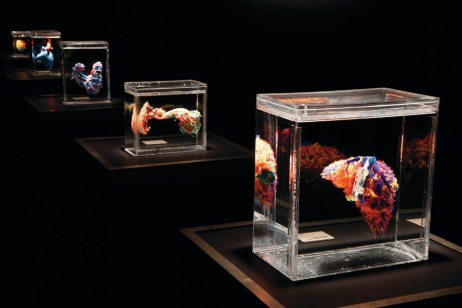 Las Vegas: BODIES | The Exhibition at the Luxor - The Specimens and Their Significance